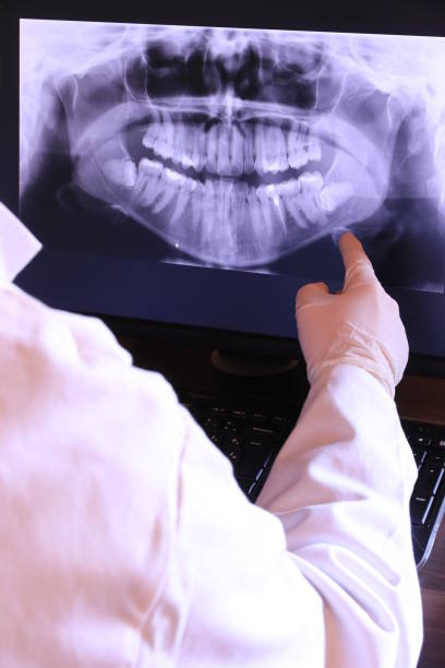 Best Emergency Tooth Extraction in Fairview, UT